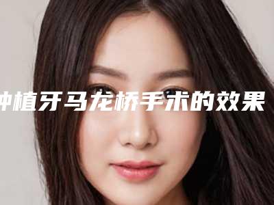 种植牙马龙桥手术的效果与优点有哪些