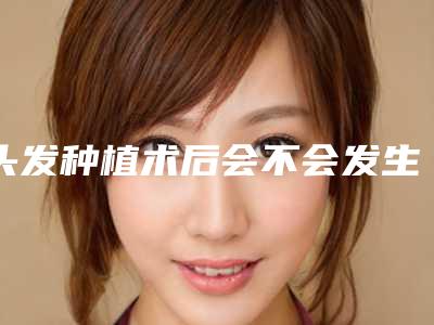 头发种植术后会不会发生副作用「头发种植术的优势和副作用各是什么」